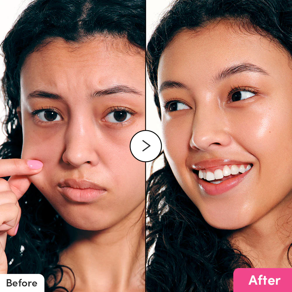 [Amazon] NAD+ Peptide Boosting Serum - Image 6