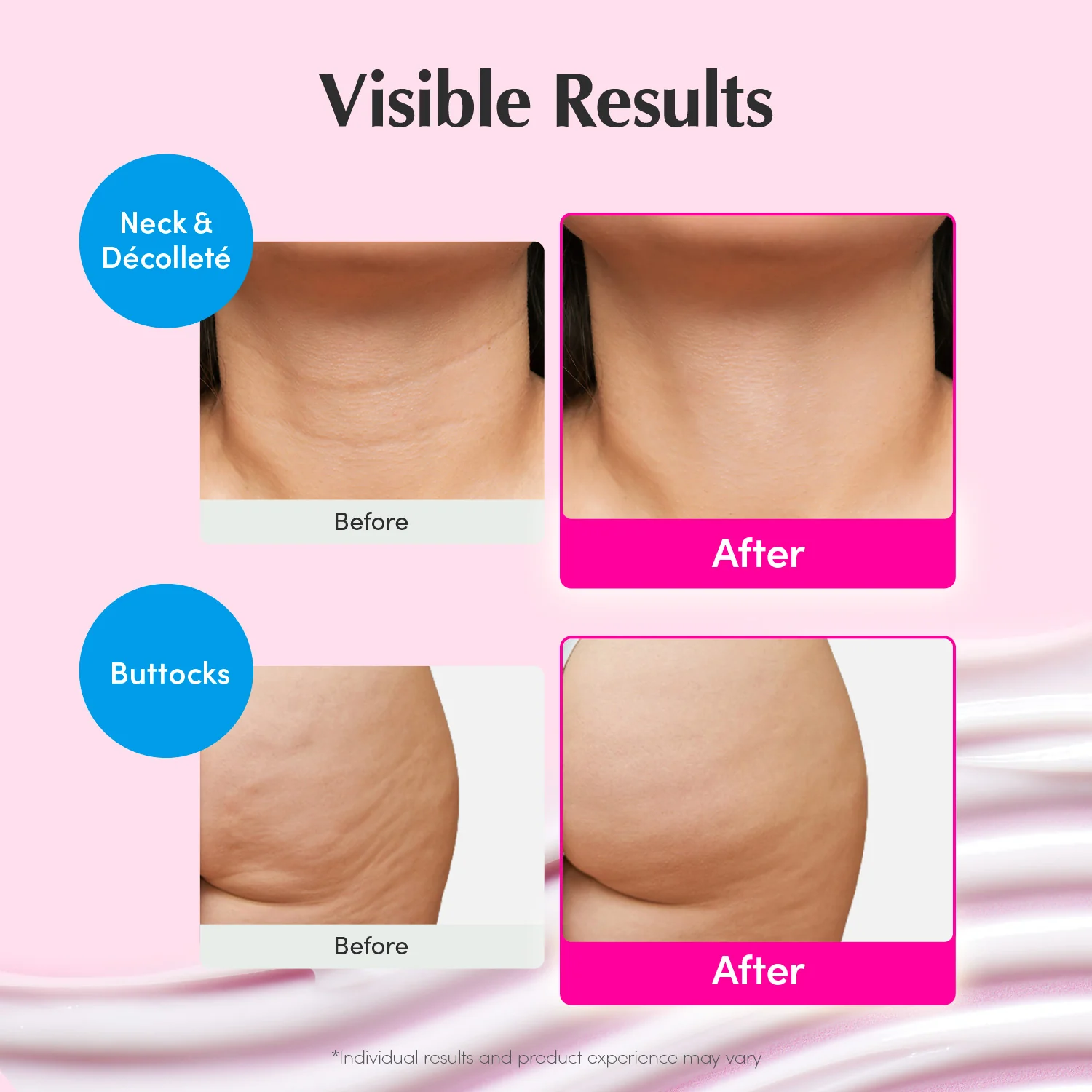 [Amazon's Chioce] NAD+ Firming & Lifting Cream - Image 4