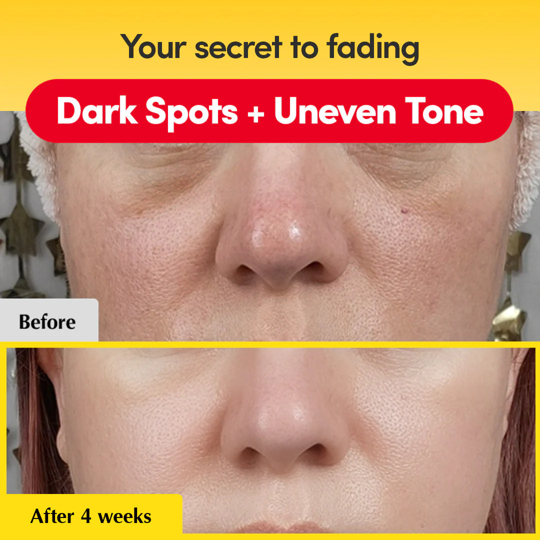 [Amazon #1] Vitamin Illuminating Serum - Image 2