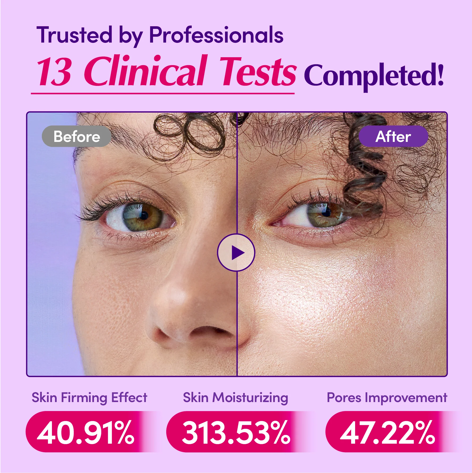[Best Deal] Bakuchiol Plumping Serum - Image 5